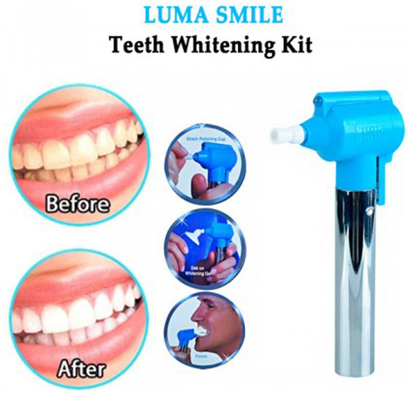 files/Luma-Smile-Tooth-Polish-Whitening-Kit.jpg